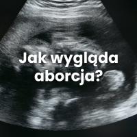 aborcjawyglad's Photo